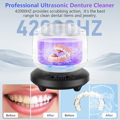 Ultrasonic Retainer Cleaner with 4 Modes (White) U5204